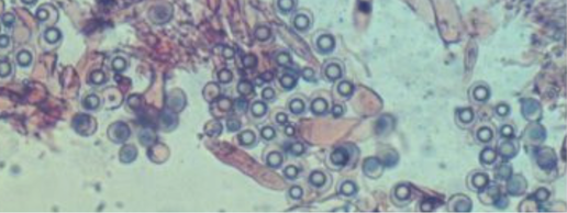 Picture of spores seen via microscope